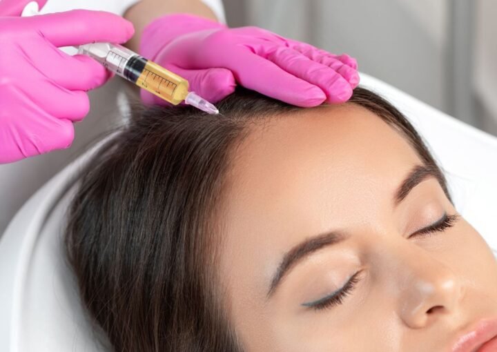 qué es el prp capilar