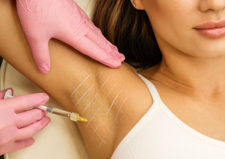 qué es la hiperhidrosis